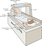 What is Bone Densitometry  ?