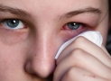 What is conjunctivitis and Treatment ?