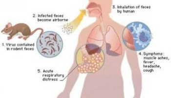 “Hantavirus” A New Type of Virus from China has started killing